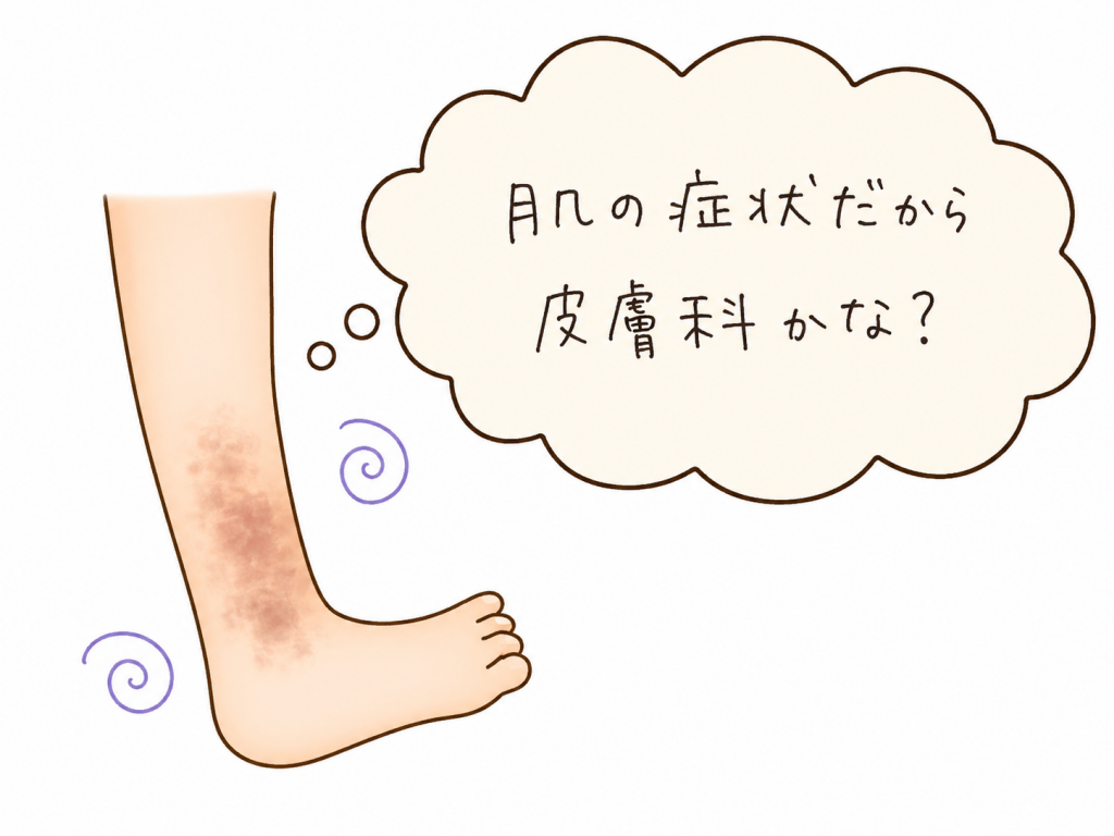 下肢静脈瘤